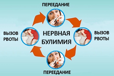 Лечение булимии в Угличе